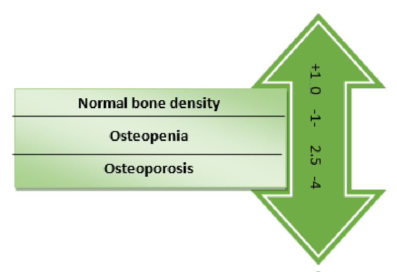 Impact of Diabetes Mellitus on Renal transplant outcome